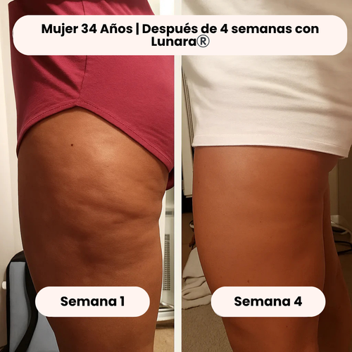 Lunara®️ Aceite Reafirmante Anti Celulitis