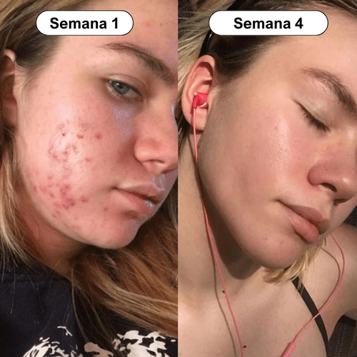 Dr. Althea 345 | Crema Calmante Anti Acné y Rosacea