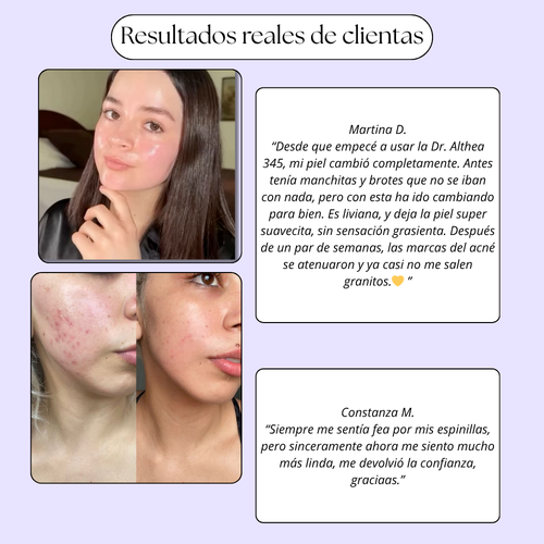 Dr. Althea 345 | Crema Calmante Anti Acné y Rosacea