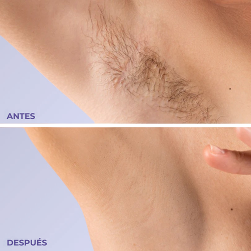 Bodycream | Crema Depilatoria Para Todo el Cuerpo