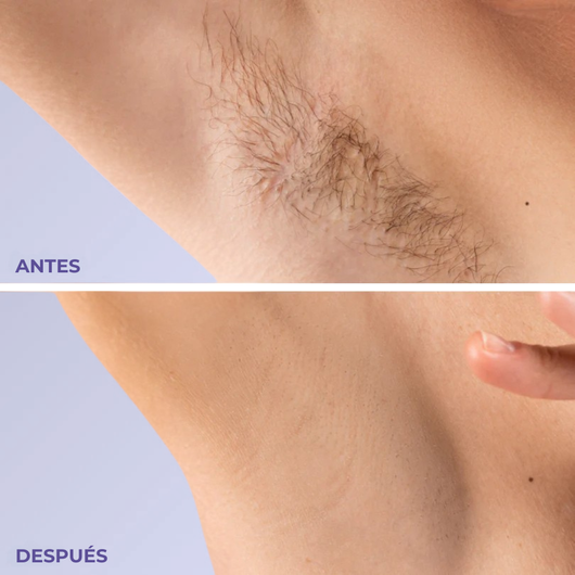 Bodycream | Crema Depilatoria Para Todo el Cuerpo